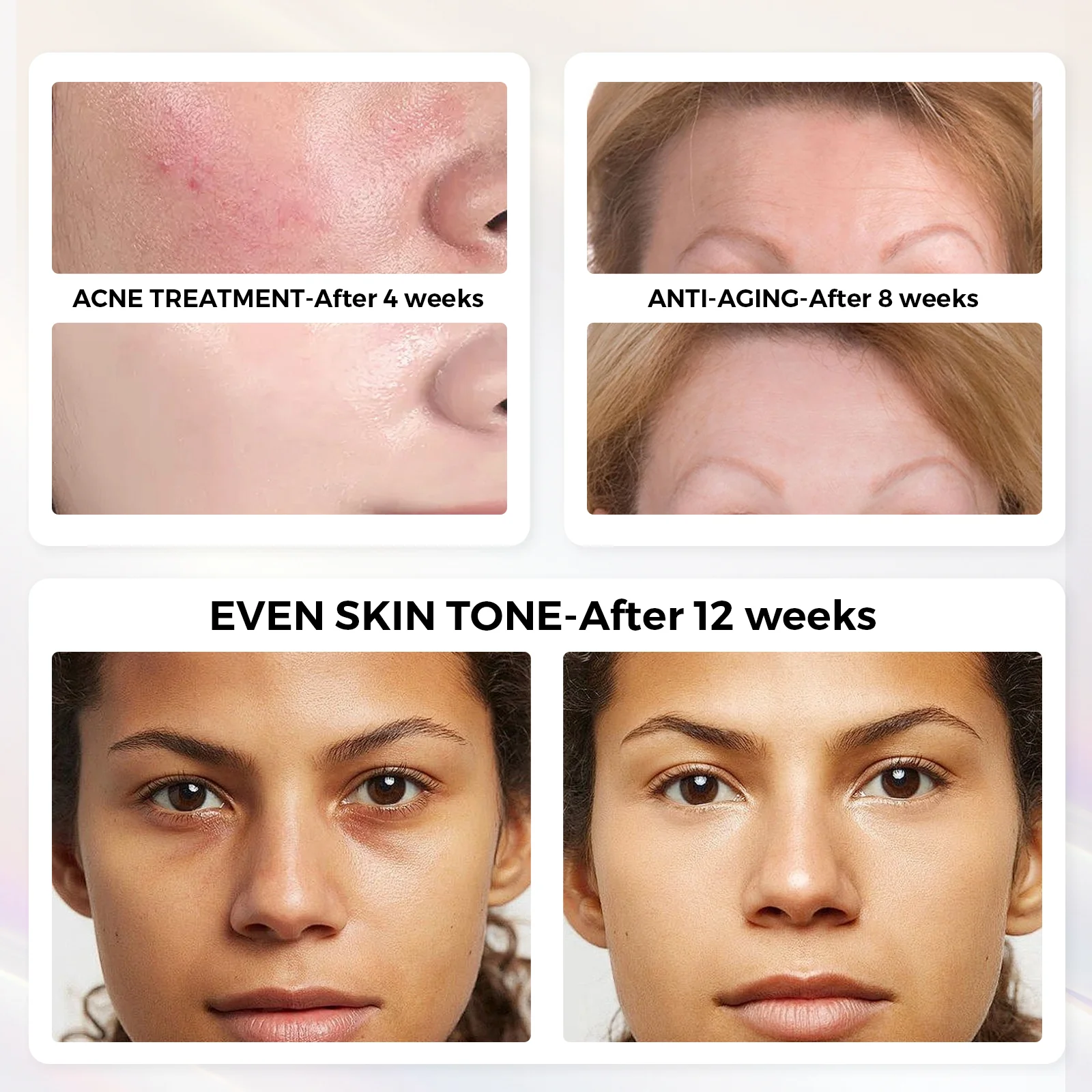 QuasarMD 3D Light Therapy Mask - Image 6