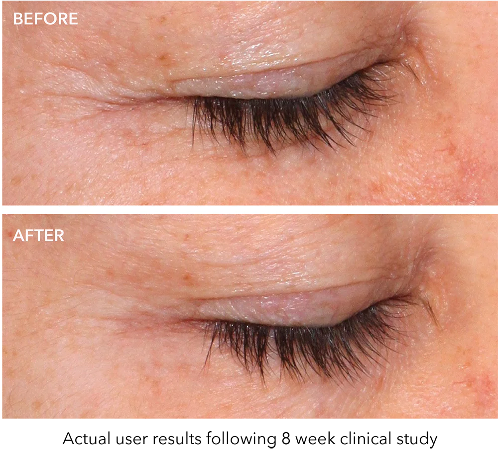 QuasarMD  Plus - Image 3